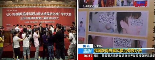 （CCTV对于中国白癜风成果转化推广大会的报道）