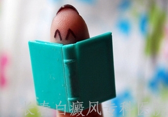 患了白癜风该怎么治疗 患了白癜风该怎么治疗
