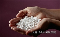 使用白癜风药物治疗注意事项 使用白癜风药物治疗注意事项