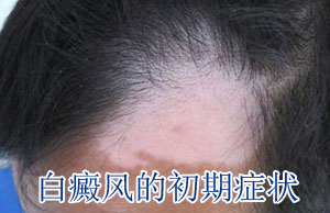 ôƲЧ